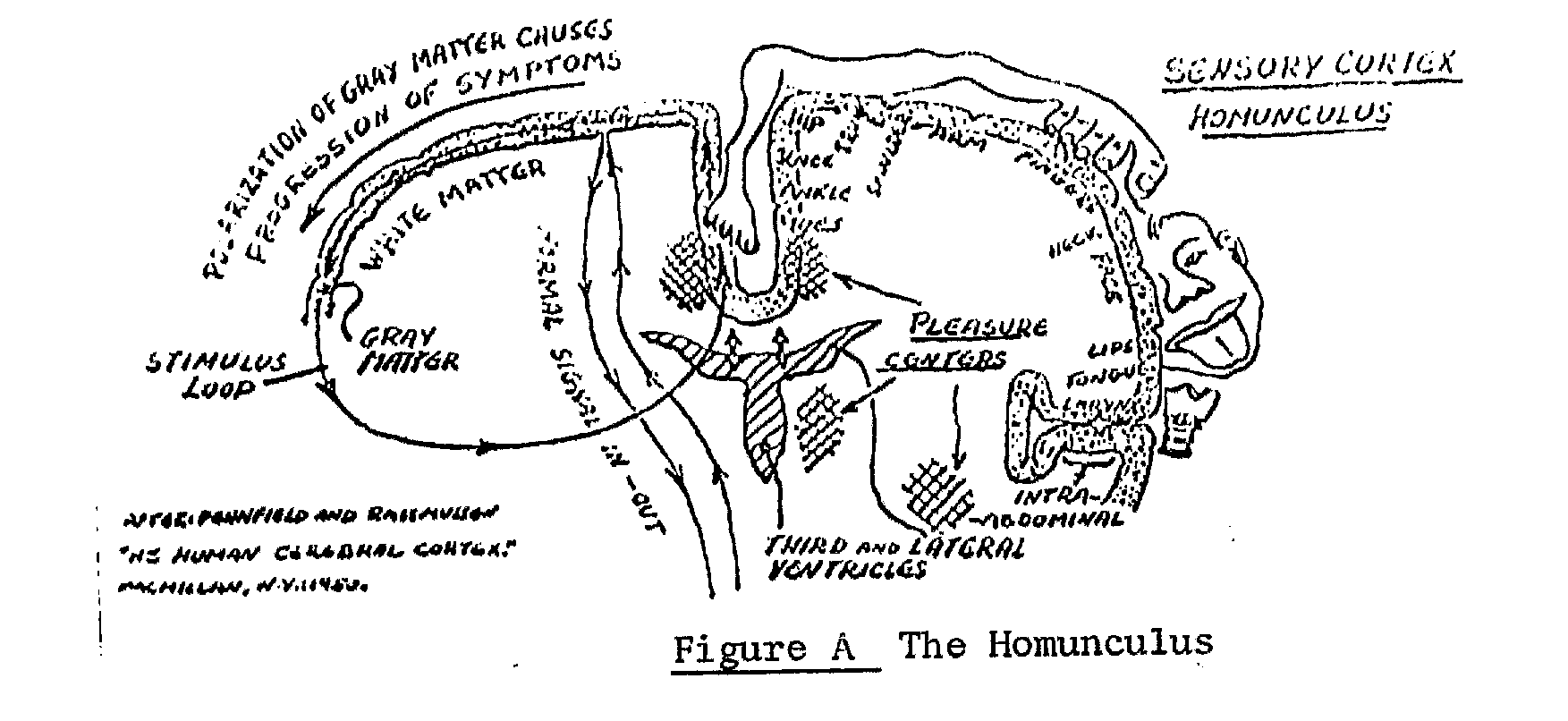 Fig A: El homúnculo